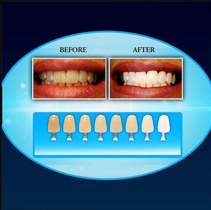 LED Light Teeth Whitening